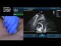 Hot Tip - Point of Care Focused Echo