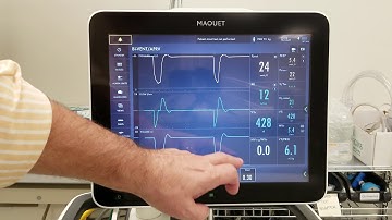 U Skill 8 Initiating BiVENT