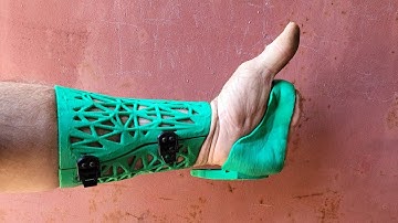 How I Print my Prosthetic Socket!  Scan to Print part 1