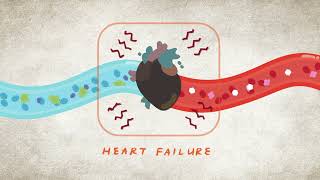 ¿Qué es la enfermedad cardiovascular? | Enfermedad renal, la enfermedad cardíaca y la diabetes