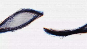 vortex count - metthb