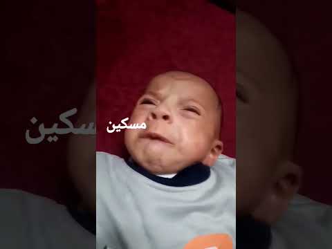 الرضيع المعنف يصفع بقوه مسكين