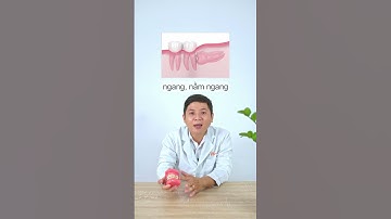 Trường hợp nào ca niềng được chỉ định nhổ răng khôn?