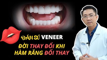 Dán Sứ Veneer | Lớp Mặt Nạ Hoàn Hảo Cho Hàm Răng Trắng Sáng Rạng Rỡ