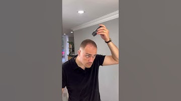 Thumbnail of Hiding Baldness #thickfiber #hairfibers #thinninghair