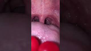 Swallowing Sphere Candiesread Description