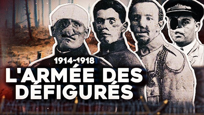 La Tragique histoire des Gueules Cassées - YouTube