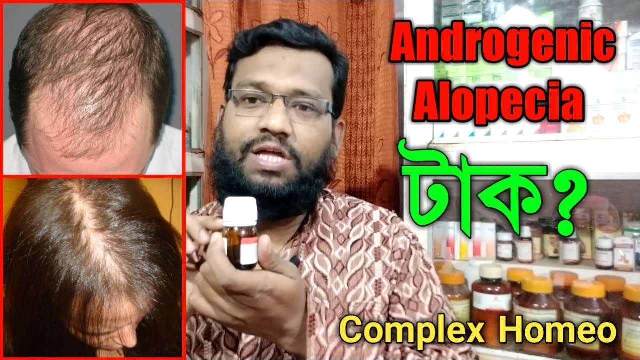 টাক মাথায় চুল গজানোর হোমিওপ্যাথি উপায় | Androgenic Alopecia Homeopathy Treatment in Bangla