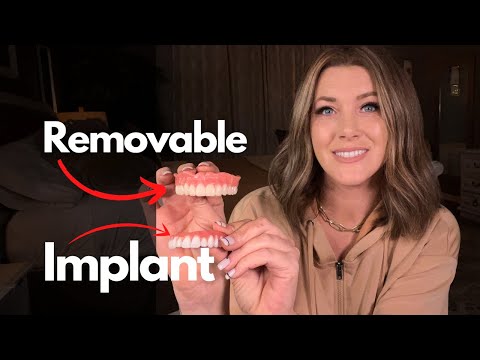 Do Implants Look