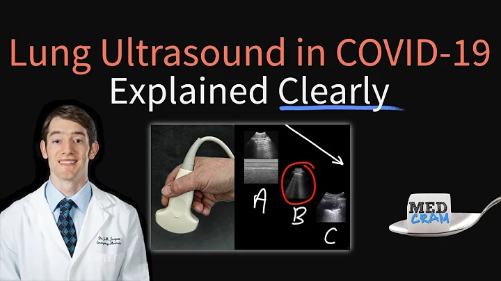 Lung Ultrasound in COVID 19: Findings, Accuracy, Pneumonia Diagnosis, Utility (POCUS) - DayDayNews
