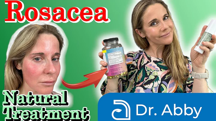 5 Natural Rosacea Treatments That Work Fast: From a Dermatologist