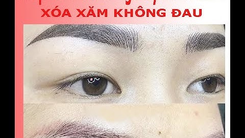 Xóa xăm lông mày bằng laser bao nhiêu lần thì sạch  | spa Ngoc Trinh