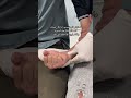اختبار ألن لتحديد إذا كان هناك انسداد بالأوعية الدموية والشرايين الواصلة إلى اليد
