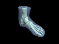 Design Video: Foot Phantom for Radiology Training