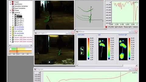 Gait Analysis with RSscan Foot Pressure Plates 3D Simi Motion