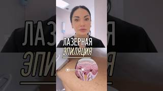 Лазерная эпиляция — это эффективный и безопасный метод удаления нежелательных волос с помощью лазера