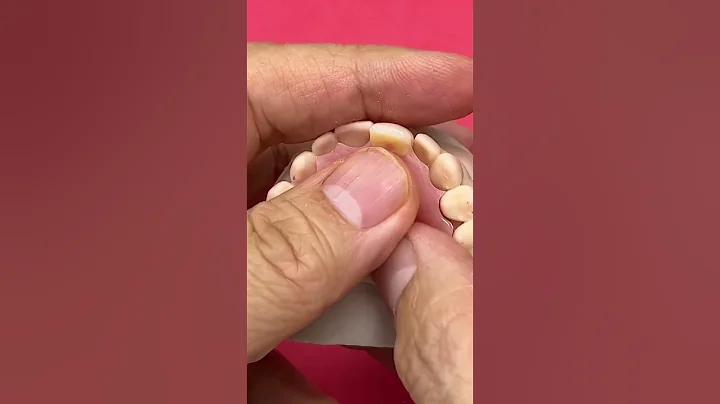 Flipper Partial @EnvisiontecMain #envisiontec