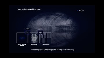 MRI - Compressed Sense- How does it work!!