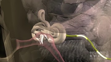 Ear Canal 3D Medical Visualization
