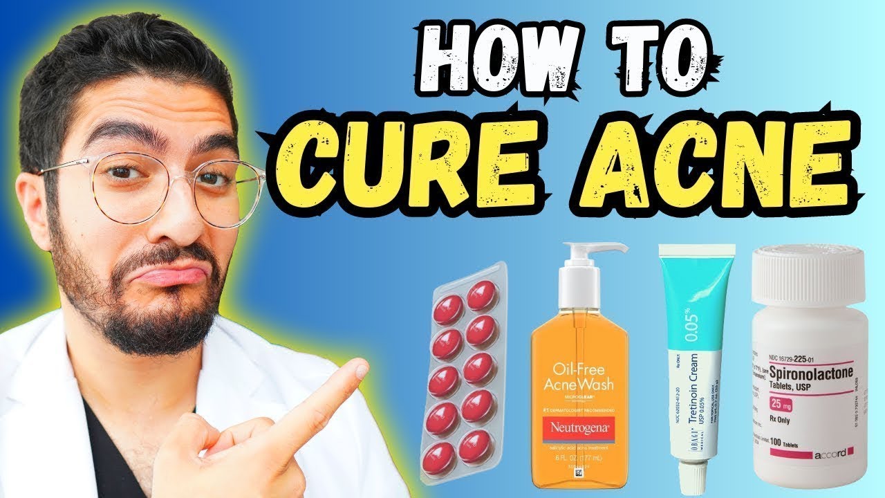 The ULTIMATE Acne Treatment Guide 2024