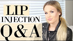 Lip Injection Experience | Pain, Cost, & Permanent?!