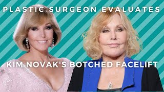 Kim Novak&#39;s Botched Facelift: Plastic Surgeon Reacts