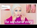 My story and tips for Re-accutane acne course | قصتي مع الريأكيوتان وحب الشباب وبعض النصايح المهمه