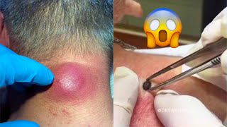 Most Extreme Beauty Treatments 2022 Best Smart and Helpful Beauty Hacks | Virtual Beauty