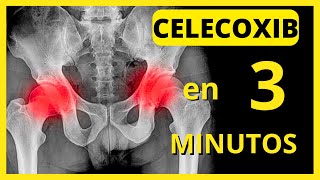 CELECOXIB 200 mg Para Qué Sirve, Efectos Secundarios y mucho más... [2023]