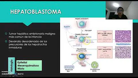 ¿Qué es el hepatoblastoma?