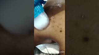 Say Goodbye to Dark Spots 😍 | Belevista Skincare