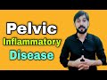 Pelvic Inflammatory Disease | Symptoms | Causes and Diagnosis