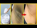 Whiten Dark Underarms Instantly Permanently | 100% Works At Home Recipe 02
