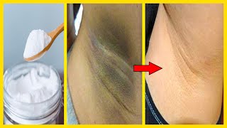 Whiten Dark Underarms Instantly Permanently | 100% Works At Home Recipe 02