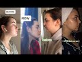 Gua sha Amazing Results Before and After Tiktok Compilation (SHOCKING)