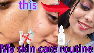 உங்களுக்கு pimples இருக்கா !Skin care for acne skin🥵/My (day skin care) 😉#viral #skincare #trending