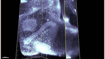 iDISCO: Cholinergic neurons in the adult mouse brain
