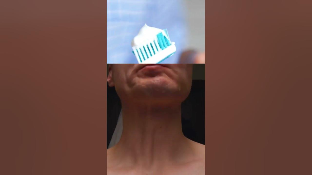 5-ways-to-remove-gutka-or-pan-masala-stains-from-your-teeth-tobacco