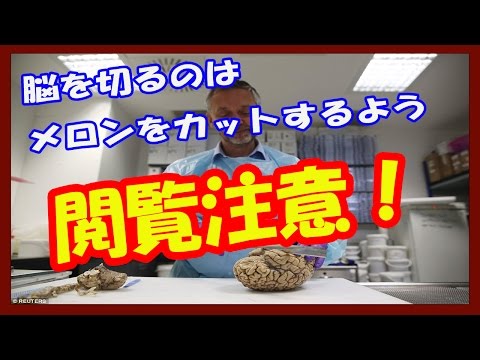 【閲覧注意】英国の脳バンクで働く理学教授は「脳を切るのはメロンをカットするよう」と言う！