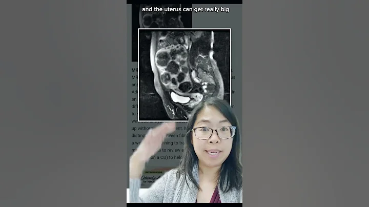 What happens to the *space* where the uterus was after a HYSTERECTOMY? Gynecologist Explains! #short