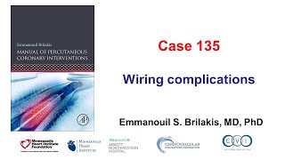 Case 135: PCI Manual - Wiring challenges