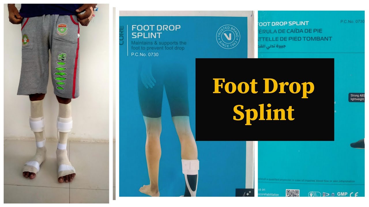 FOOT DROP SPLINT