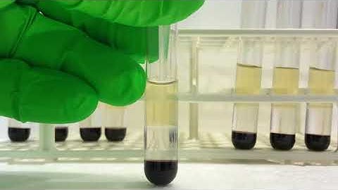 Isolation of peripheral blood mononuclear cells (PBMCs) from small volume of blood