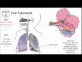 Respiratory Viruses: Intro, Part 1