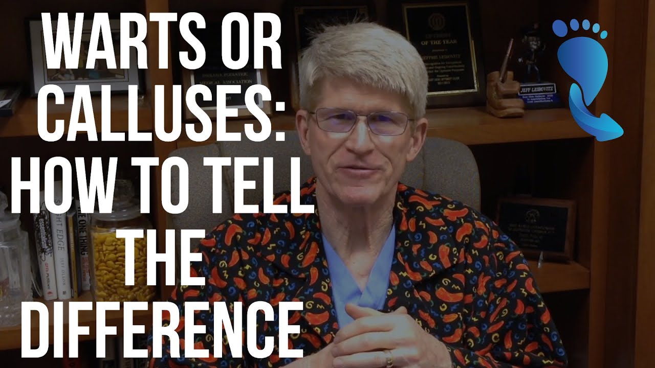 Warts or Calluses: How to Tell the Difference