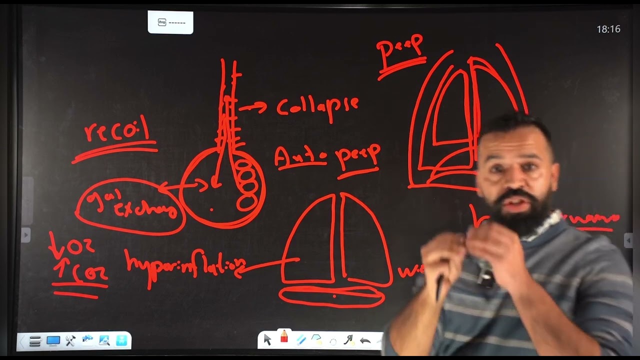شرح محاضرة البكج الوزاري للعناية المركزة /part 1/COPD