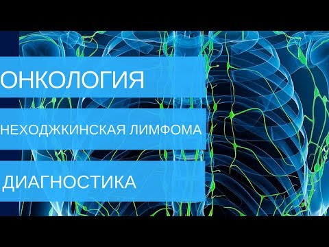 НЕХОДЖКИНСКАЯ ЛИМФОМА - диагностика на 1,2,3,4 стадии