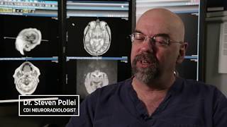 How MRI Can Help Diagnose and Track Multiple Sclerosis