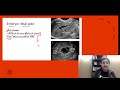 Obstetrics USG | Must know Points with Dr. Zainab Vora