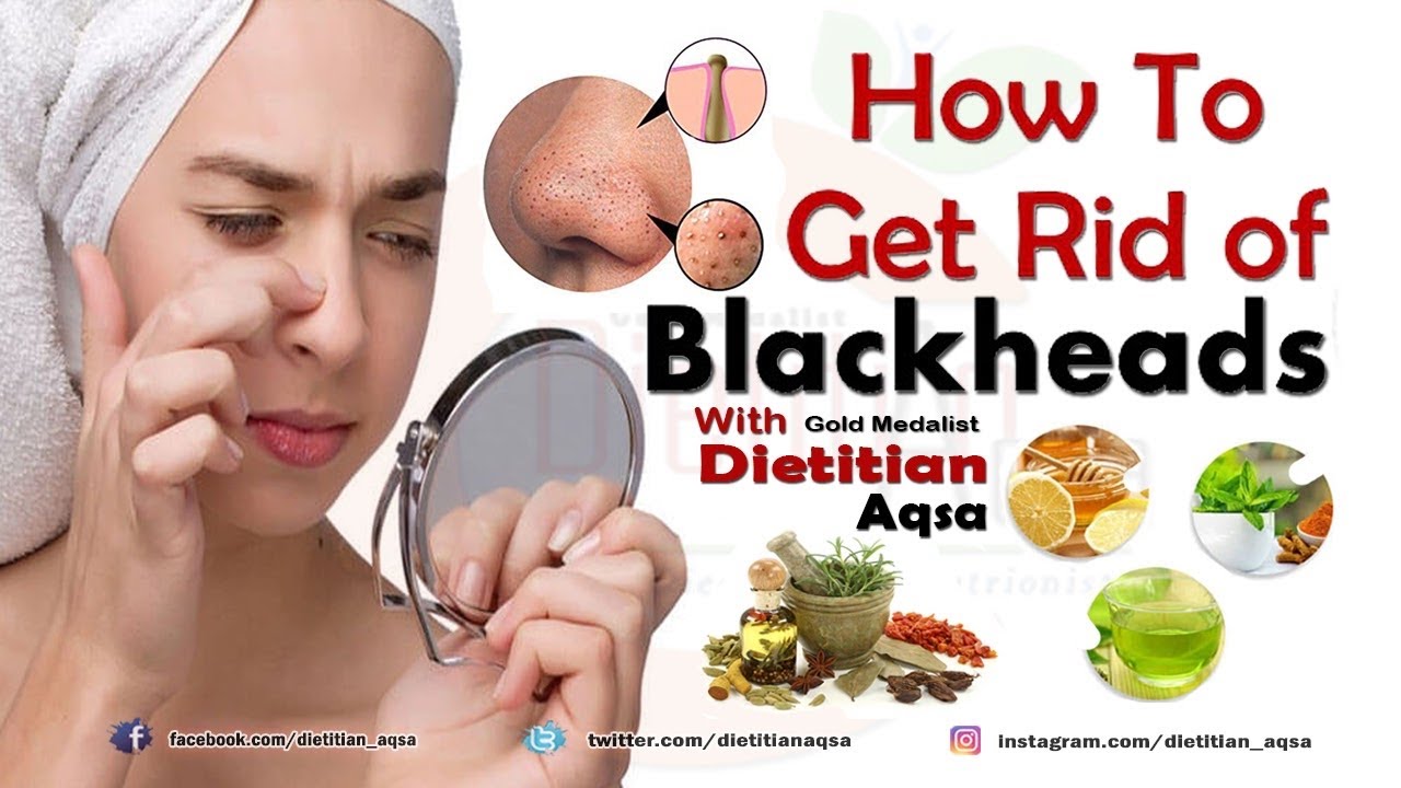 How To Get Rid Of Blackheads Home Remedies